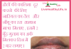 होठों की कालिमा black lips
