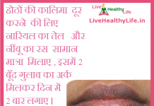 होठों की कालिमा black lips
