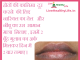 होठों की कालिमा black lips