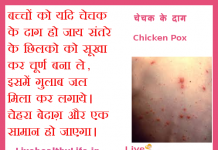 चेचक के दाग Chicken Pox