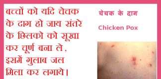 Chicken Pox