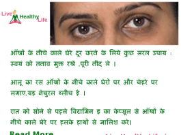 dark circle under eye