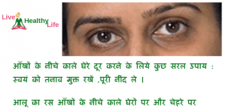 dark circle under eye