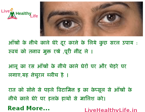 आँखों के नीचे काले घेरे dark circle under eye