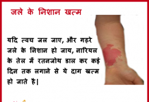 get rid of burn scars marks