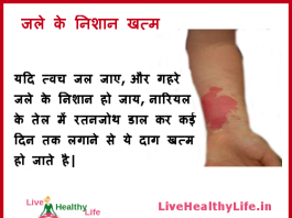 get rid of burn scars marks