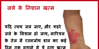 जले के निशान – Get rid of burn scars and marks get rid of burn scars marks
