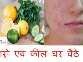 how to get rid of pimples fast