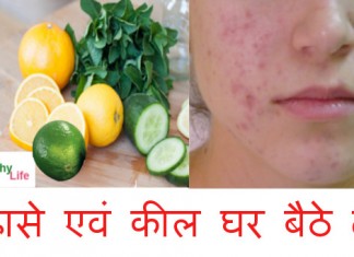 how to get rid of pimples fast