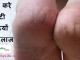 जानिए फटी एड़ियों को ठीक करने के आसान उपाय – How to heal cracked feet how to heal cracked feet