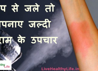 भाप से जले तो अपनाए जल्दी आराम के उपचार – Steam burn fast relief home remedies steam burn fast relief home remedies
