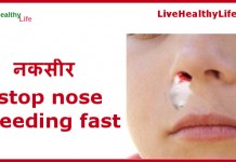 stop nose bleeding fast