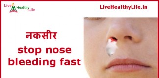 stop nose bleeding fast