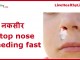 stop nose bleeding fast