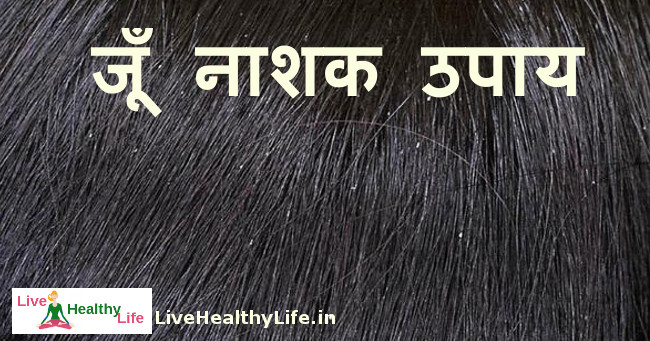 home remedies for louse in hair