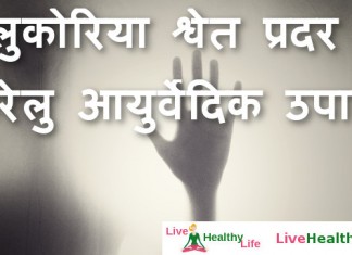 लुकोरिया श्वेत प्रदर घरेलु आयुर्वेदिक उपाय – likoria whitish discharge home remedies likoria whitish discharge home remedies