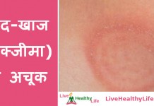 दाद और खुजली (एक्जीमा) का घरेलु उपचार  – Ring worm and eczema home remedy Ring worm and eczema home remedy
