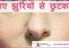 पाए झुर्रियों से छुटकारा – Wrinkle free face with simple home remedies पाए झुर्रियों से छुटकारा - Wrinkle free face with simple home remedies