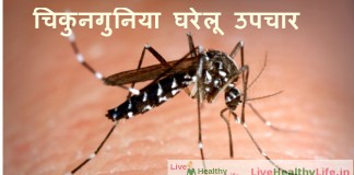 चिकुनगुनिया घरेलू उपचार – Home Remedies Of Chikungunya home remedies of chikungunya