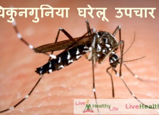 चिकुनगुनिया घरेलू उपचार – Home Remedies Of Chikungunya home remedies of chikungunya