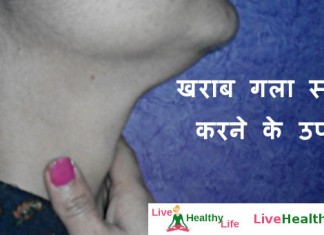 खराब गला स्वस्थ करने के उपाय - Home Remedies for Sore Throat