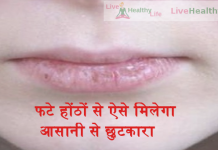 फटे होंठों से ऐसे मिलेगा आसानी से छुटकारा cracked lips cracked lips