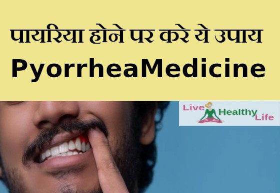 पायरिया होने पर करे ये उपाय , Pyorrhea Treatment Medicine pyorrhea