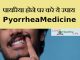 पायरिया होने पर करे ये उपाय , Pyorrhea Treatment Medicine pyorrhea