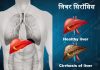 लिवर सिरॉसिस – Liver Cirrhosis in Hindi