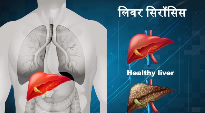 लिवर सिरॉसिस – Liver Cirrhosis in Hindi