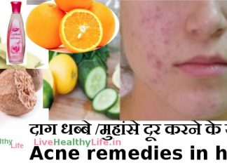 remove acne