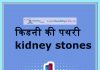 किडनी की पथरी kidney stones – Symptoms and causes in Hindi kidneystones