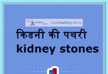 किडनी की पथरी kidney stones – Symptoms and causes in Hindi kidneystones