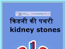 kidneystones