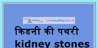 किडनी की पथरी kidney stones – Symptoms and causes in Hindi kidneystones