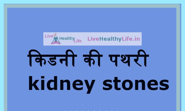 किडनी की पथरी kidney stones – Symptoms and causes in Hindi kidneystones