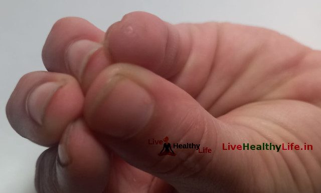 समान मुद्रा के लाभ Benefits of Samaan Mudra samaan mudra