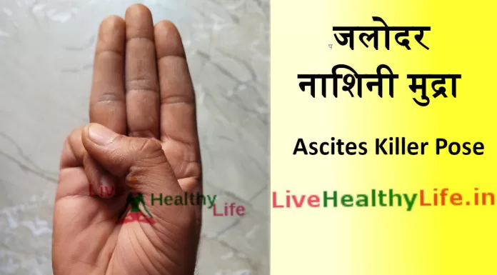 जलोदर नाशिनी मुद्रा लगाने की विधि एवं लाभ Ascites killer pose yoga जलोदर नाशिनी मुद्रा